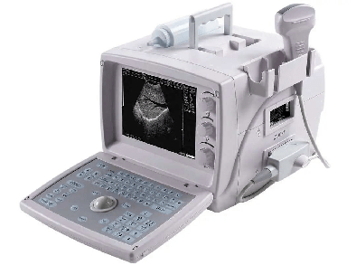 超聲診斷儀 超聲診斷儀